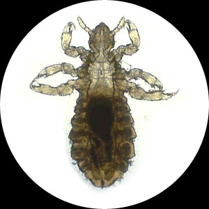 Body Lice (Body Louse)